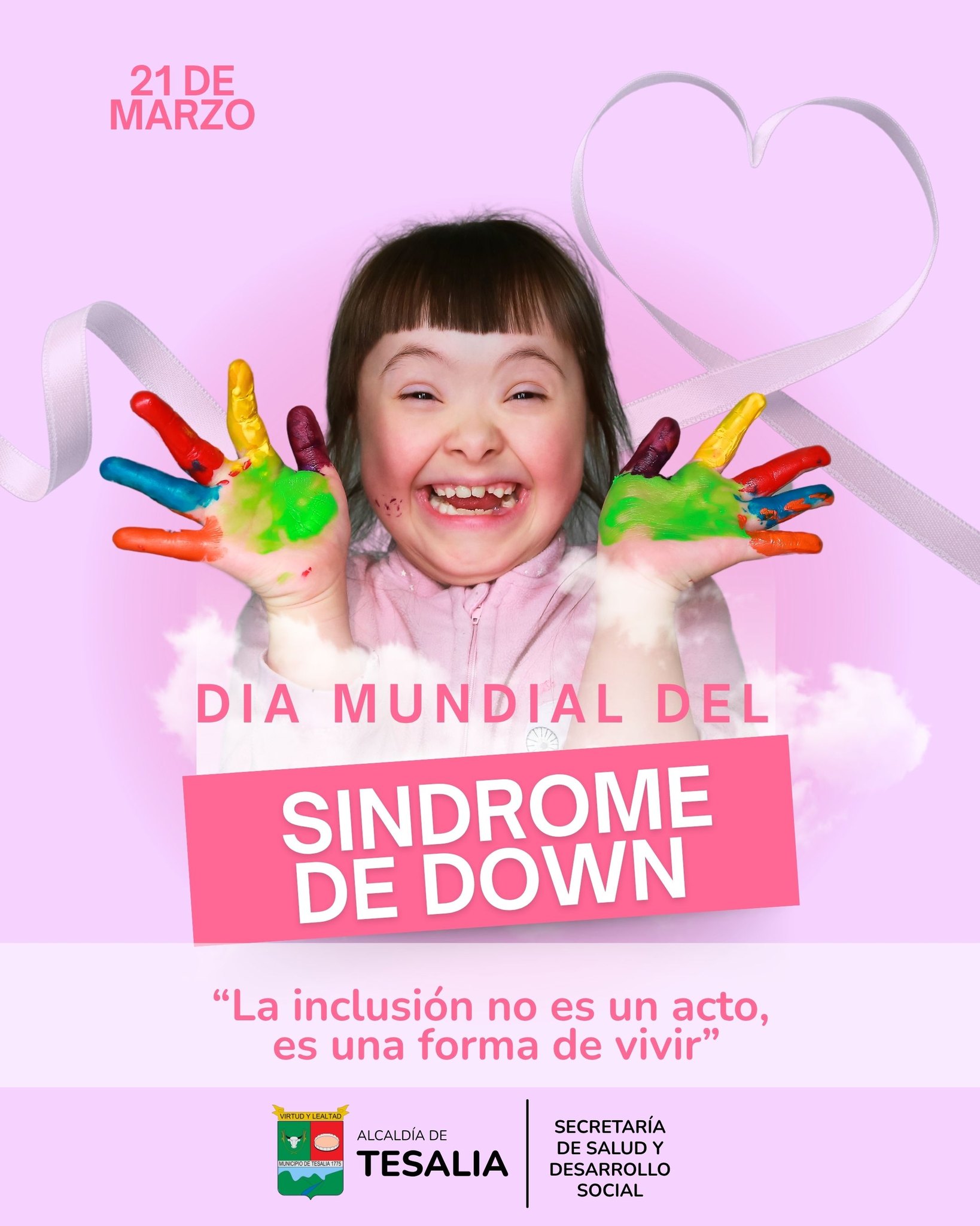 Noticia - 💙🌈 DÍA MUNDIAL DEL SÍNDROME DE DOWN: CELEBRAMOS LA DIVERSIDAD 🌈💙